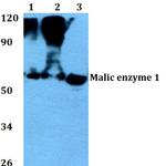 ME1 Antibody in Western Blot (WB)