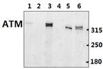 ATM Antibody in Western Blot (WB)