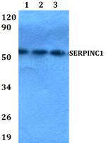 SERPINC1 Antibody in Western Blot (WB)