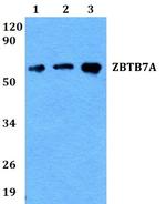 Pokemon Antibody in Western Blot (WB)