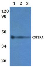 CSF2RA Antibody in Western Blot (WB)
