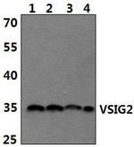 VSIG2 Antibody in Western Blot (WB)