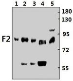 Prothrombin Antibody in Western Blot (WB)