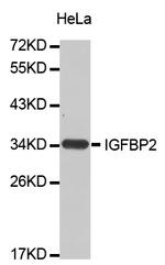 IGFBP2 Antibody in Western Blot (WB)