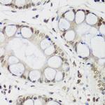 HP1 gamma Antibody in Immunohistochemistry (Paraffin) (IHC (P))