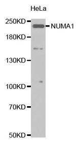 FANCI Antibody in Western Blot (WB)