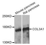 Collagen I/III Antibody in Western Blot (WB)