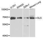 Glutaminase Antibody in Western Blot (WB)