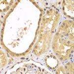 XIAP Antibody in Immunohistochemistry (Paraffin) (IHC (P))