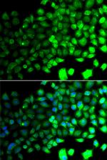 AMPK alpha-2 Antibody in Immunocytochemistry (ICC/IF)