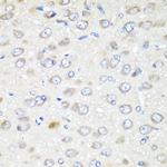 GABARAPL2 Antibody in Immunohistochemistry (Paraffin) (IHC (P))