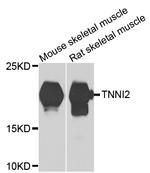 TNNI2 Antibody in Western Blot (WB)