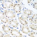 Nuclear Matrix Protein p84 Antibody in Immunohistochemistry (Paraffin) (IHC (P))