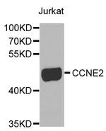 Cyclin E2 Antibody in Western Blot (WB)