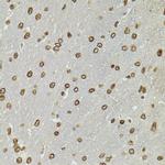 CDX2 Antibody in Immunohistochemistry (Paraffin) (IHC (P))