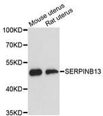 SERPINB13 Antibody in Western Blot (WB)