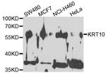 Cytokeratin 10 Antibody in Western Blot (WB)