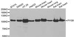 GPBB Antibody in Western Blot (WB)