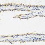 HAI-1 Antibody in Immunohistochemistry (Paraffin) (IHC (P))