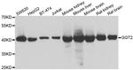 GOT2 Antibody in Western Blot (WB)