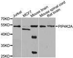 PIP4K2A Antibody in Western Blot (WB)