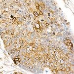 CD178 Antibody in Immunohistochemistry (Paraffin) (IHC (P))