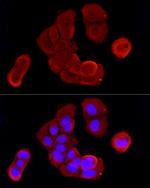 Cytokeratin 19 Antibody in Immunocytochemistry (ICC/IF)