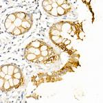 Cytokeratin 19 Antibody in Immunohistochemistry (Paraffin) (IHC (P))