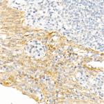 Cytokeratin 19 Antibody in Immunohistochemistry (Paraffin) (IHC (P))