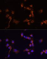 c-Abl Antibody in Immunocytochemistry (ICC/IF)