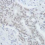 XRCC1 Antibody in Immunohistochemistry (Paraffin) (IHC (P))