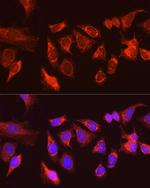 ATG13 Antibody in Immunocytochemistry (ICC/IF)