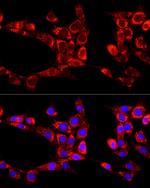 ATG13 Antibody in Immunocytochemistry (ICC/IF)