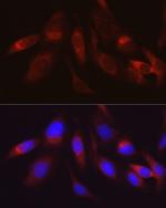 HK2 Antibody in Immunocytochemistry (ICC/IF)