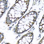 HK2 Antibody in Immunohistochemistry (Paraffin) (IHC (P))