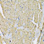 HK2 Antibody in Immunohistochemistry (Paraffin) (IHC (P))