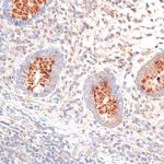 KIR3DL3 Antibody in Immunohistochemistry (Paraffin) (IHC (P))