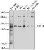 SCN1B Antibody in Western Blot (WB)