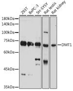 SLC11A2 Antibody in Western Blot (WB)