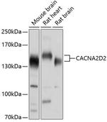 CACNA2D2 Antibody in Western Blot (WB)