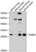 RAB34 Antibody in Western Blot (WB)