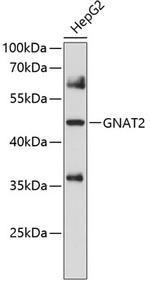 GNAT2 Antibody in Western Blot (WB)