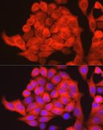 PHGDH Antibody in Immunocytochemistry (ICC/IF)