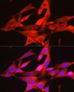 PHGDH Antibody in Immunocytochemistry (ICC/IF)