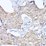 Cathepsin F Antibody in Immunohistochemistry (Paraffin) (IHC (P))