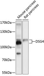 Desmoglein 4 Antibody in Western Blot (WB)