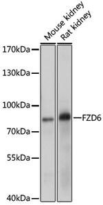 FZD6 Antibody in Western Blot (WB)