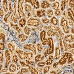 LGMN Antibody in Immunohistochemistry (Paraffin) (IHC (P))