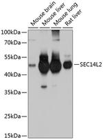 SEC14L2 Antibody in Western Blot (WB)