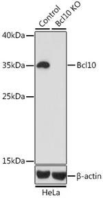 Bcl-10 Antibody